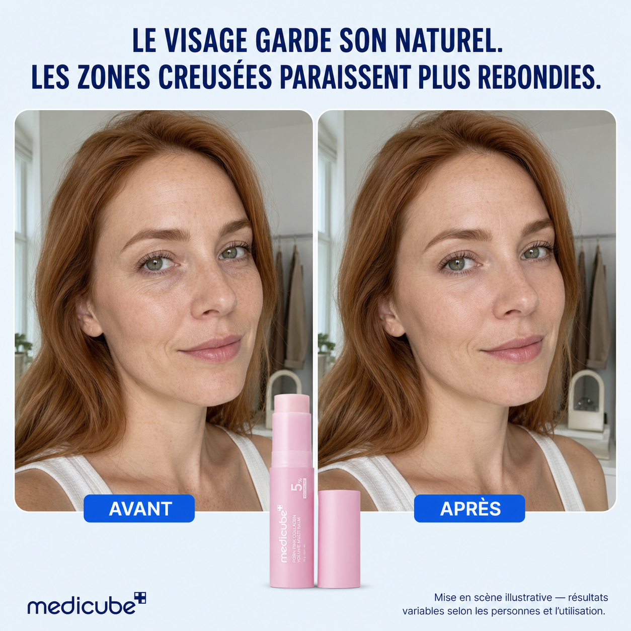 MEDICUBE PDRN VOLUME