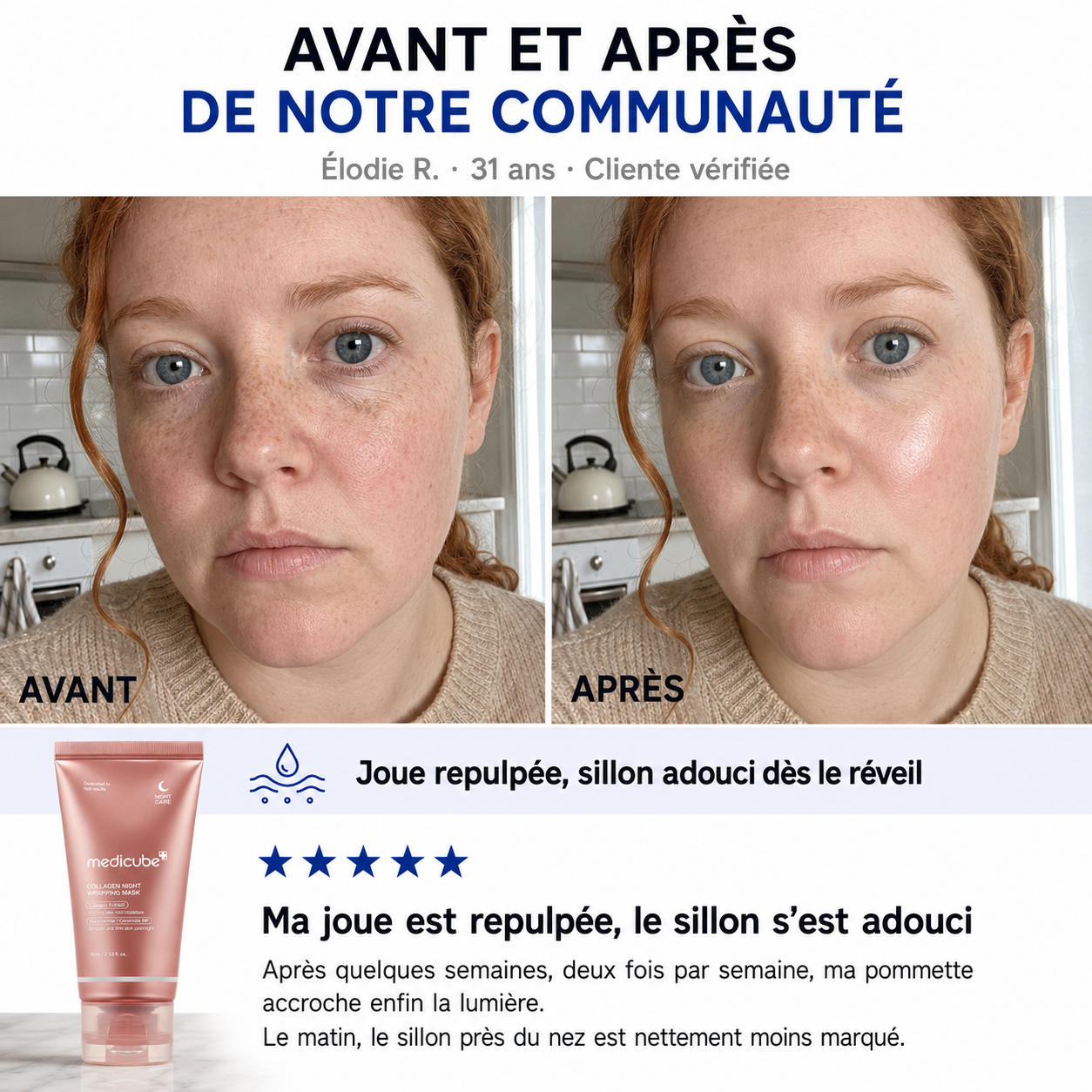 tetiloa::medicube-peel-off-test_avis_1