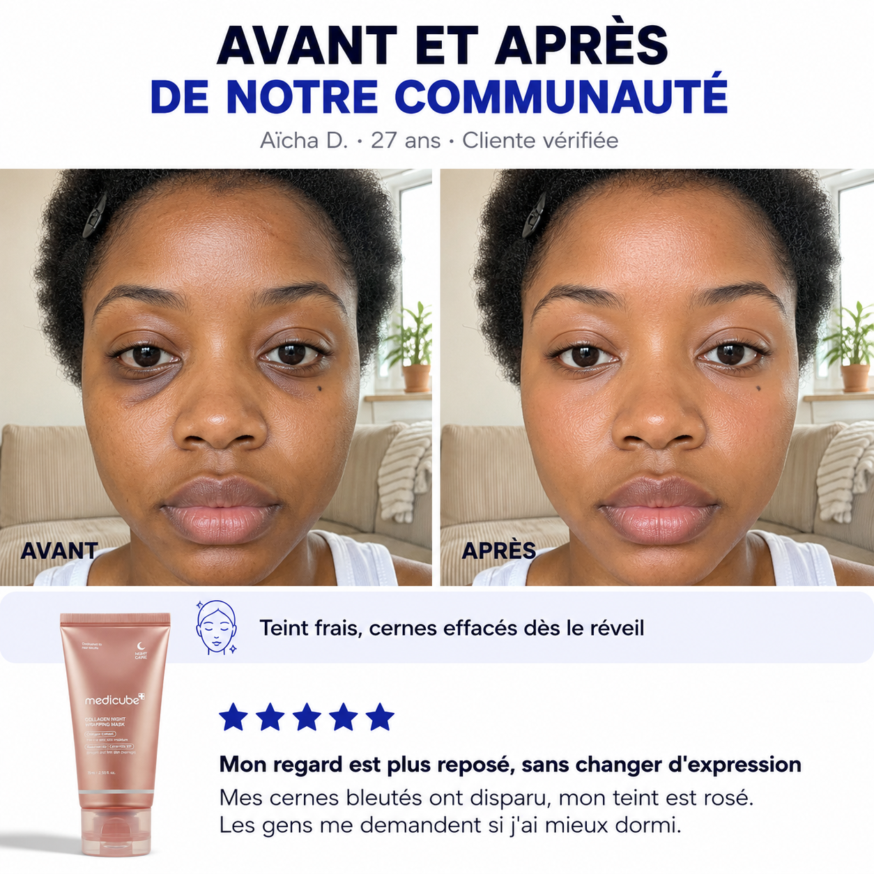 tetiloa::medicube-peel-off-test_avis_4